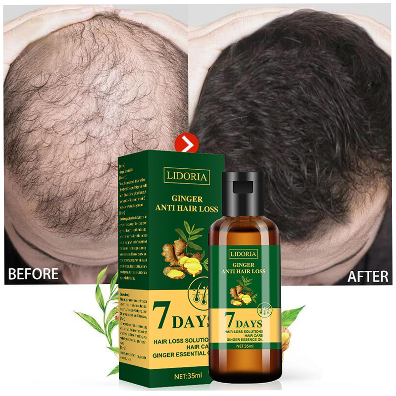 Hair Care Fragrance Essential Oil - Ginger Hair Growth Essential Oil Natural