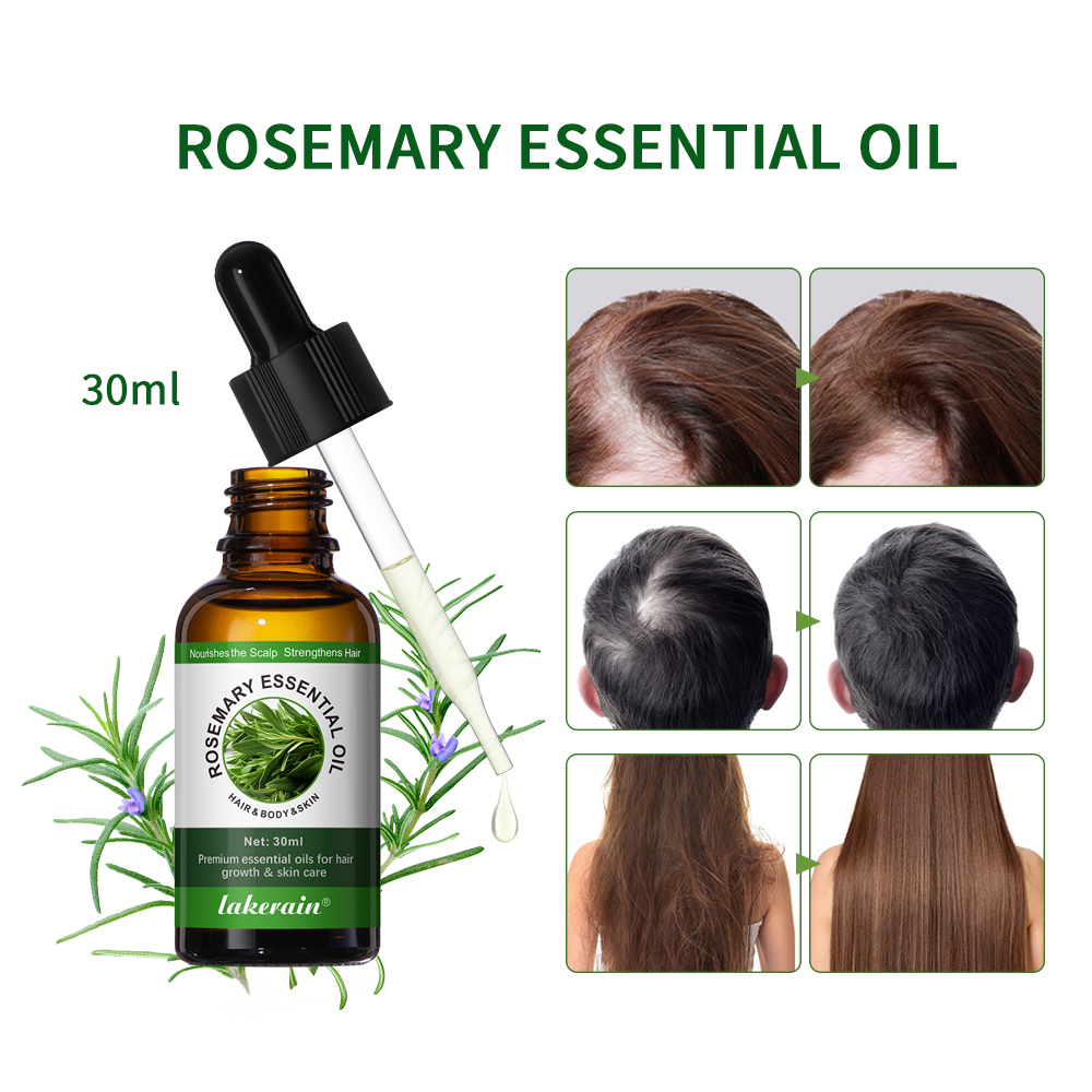 Hair Care For Hair Fall - 30ML Rosemary Hair Care Oil Anti-Breakage