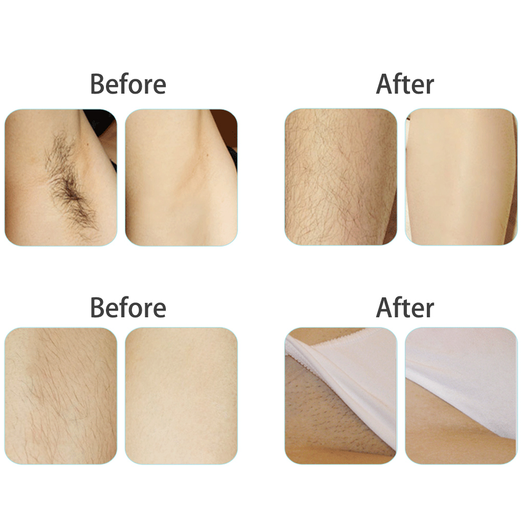 400g Hair Removal Wax Beans Sk – Hair Care Honey Bewertung und Preis