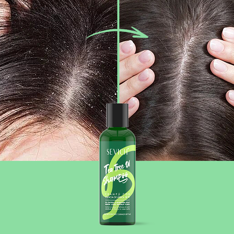 Tea Tree Essence Shampoo Hair  – Hair Care Conditioner Bewertung und Preis