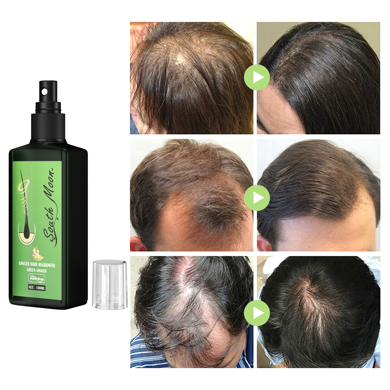Ginger Hair Density Serum Spra – Hair Care For Hair Fall Bewertung und Preis