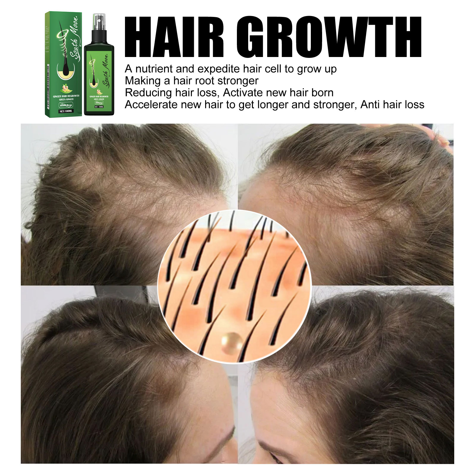 Ginger Hair Density Serum Spra – Hair Care For Hair Fall Bewertung und Preis