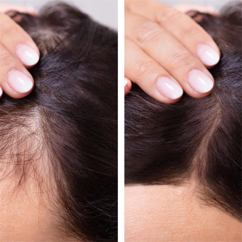 Ginger Hair Growth Essential O – Hair Care Fragrance Essential Oil Bewertung und Preis