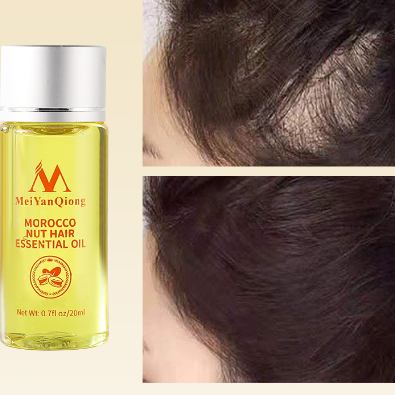 20ML Essential Oil for Hair Gr – Hair Care Fragrance Essential Oil Bewertung und Preis