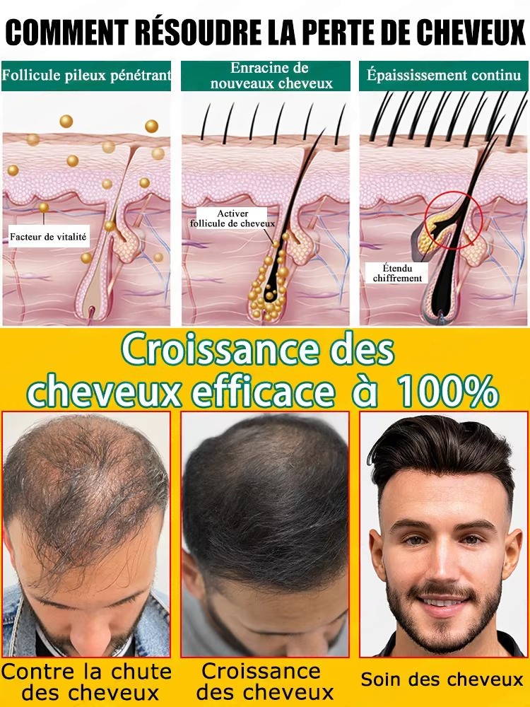 Anti Hair Loss Growth Serum, R – Hair Care For Hair Fall Bewertung und Preis