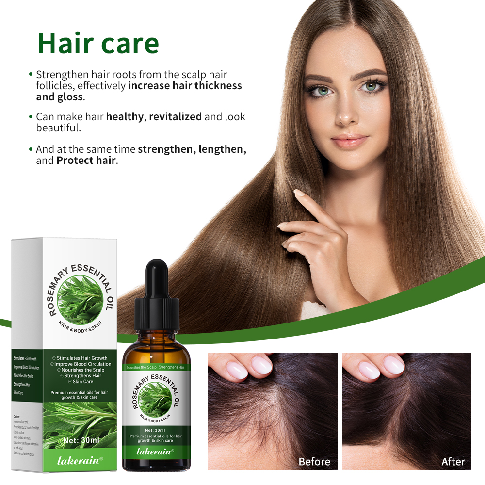 30ML Rosemary Hair Care Oil An – Hair Care For Hair Fall Bewertung und Preis