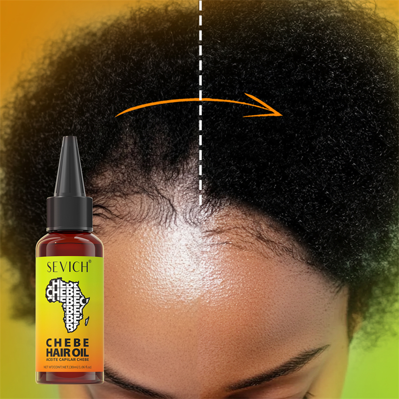 Chebe Fast Hair Growth Oil Afr – Hair Care Fragrance Essential Oil Bewertung und Preis