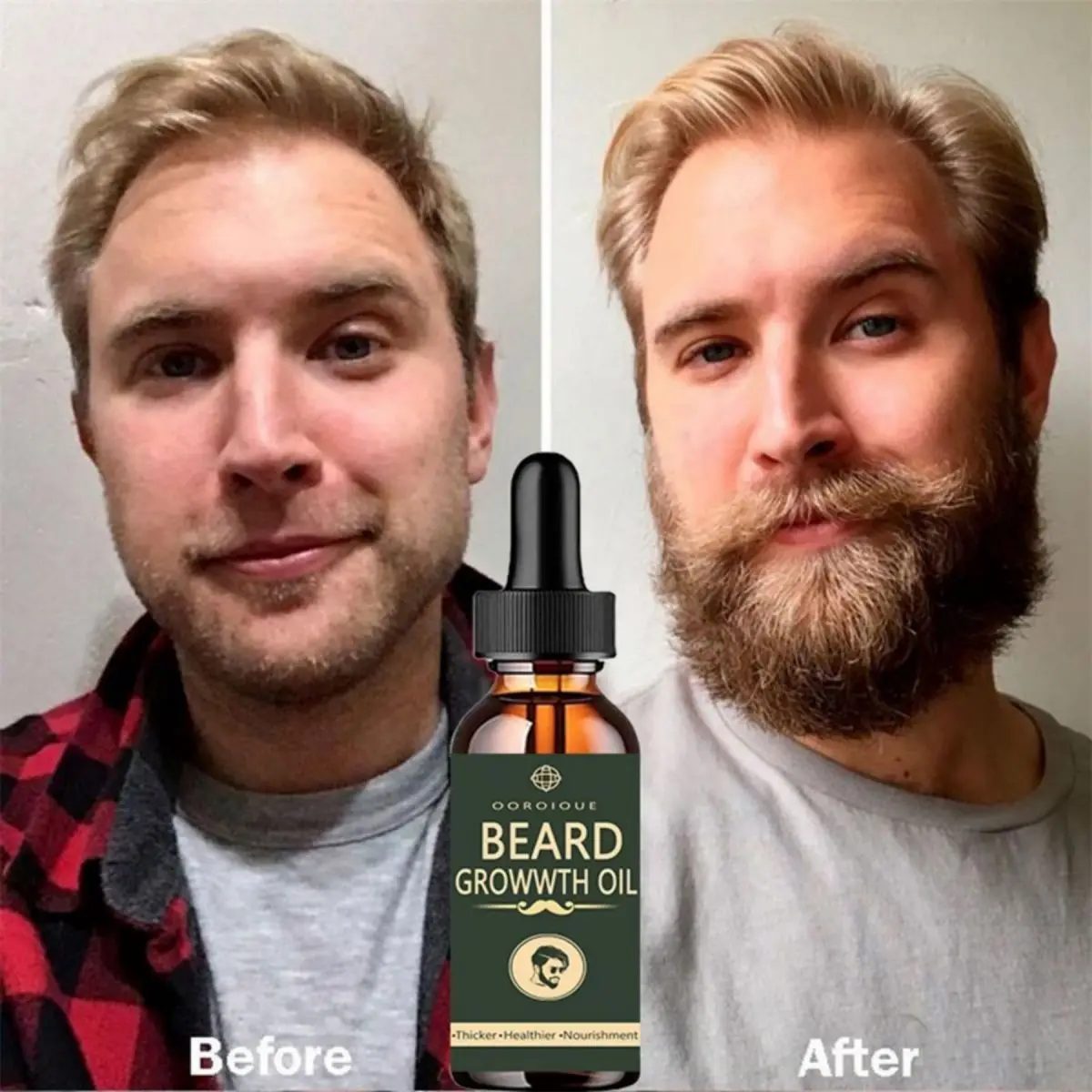 Fast Beard Growth Oil Beard Oi – Hair Care Fragrance Essential Oil Bewertung und Preis