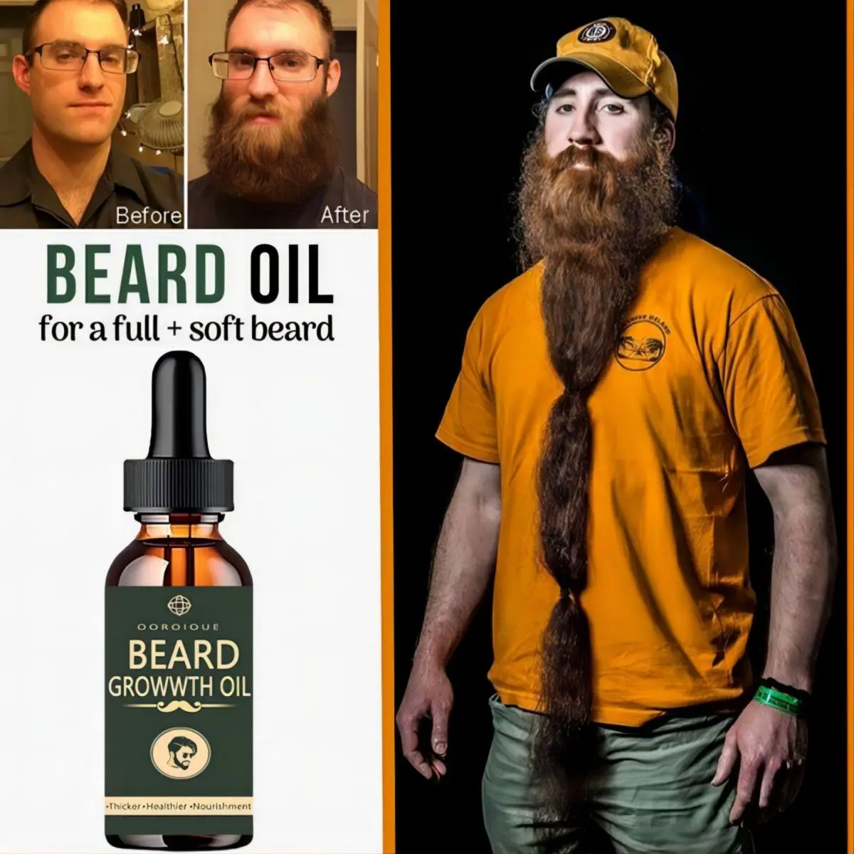 Fast Beard Growth Oil Beard Oi – Hair Care Fragrance Essential Oil Bewertung und Preis