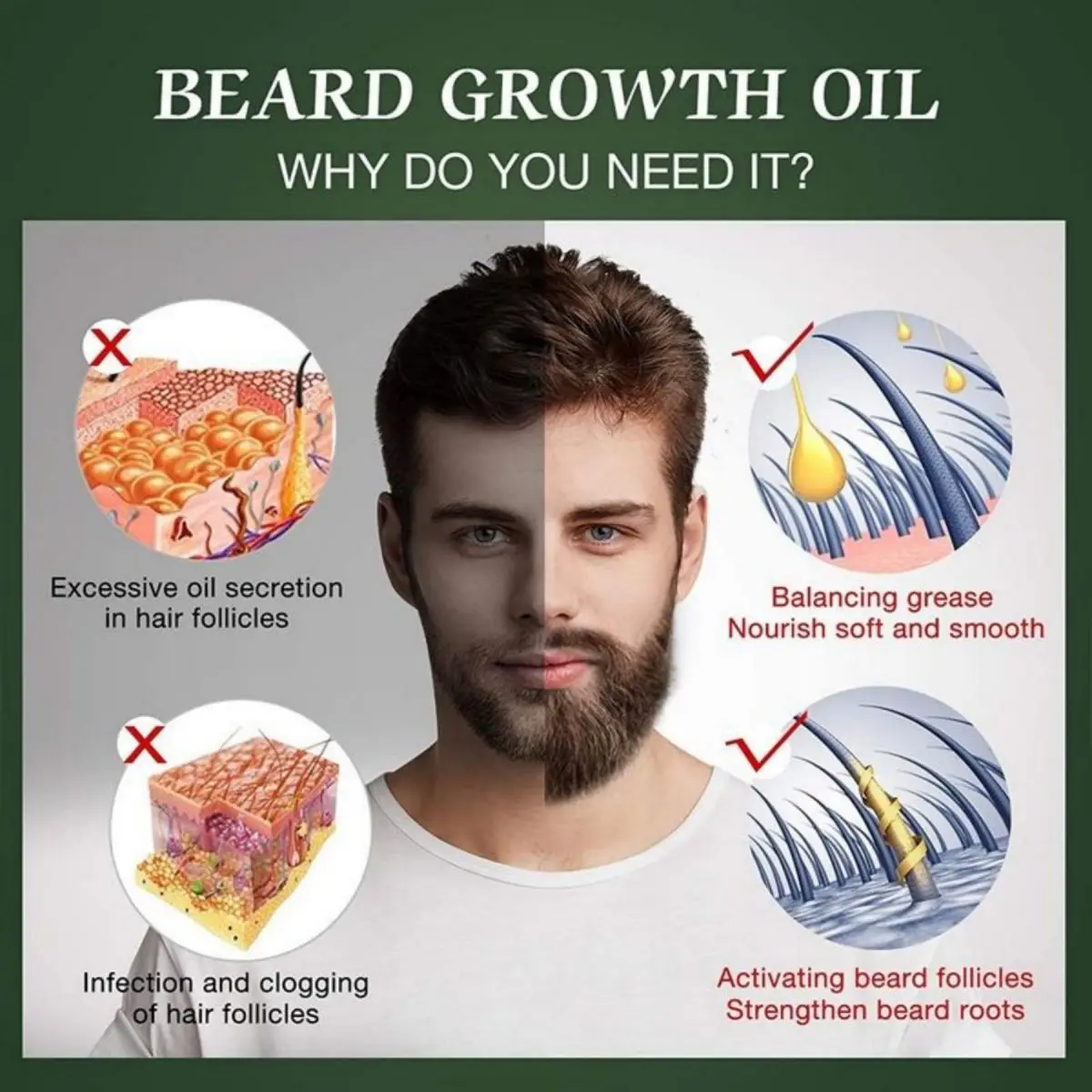 Fast Beard Growth Oil Beard Oi – Hair Care Fragrance Essential Oil Bewertung und Preis