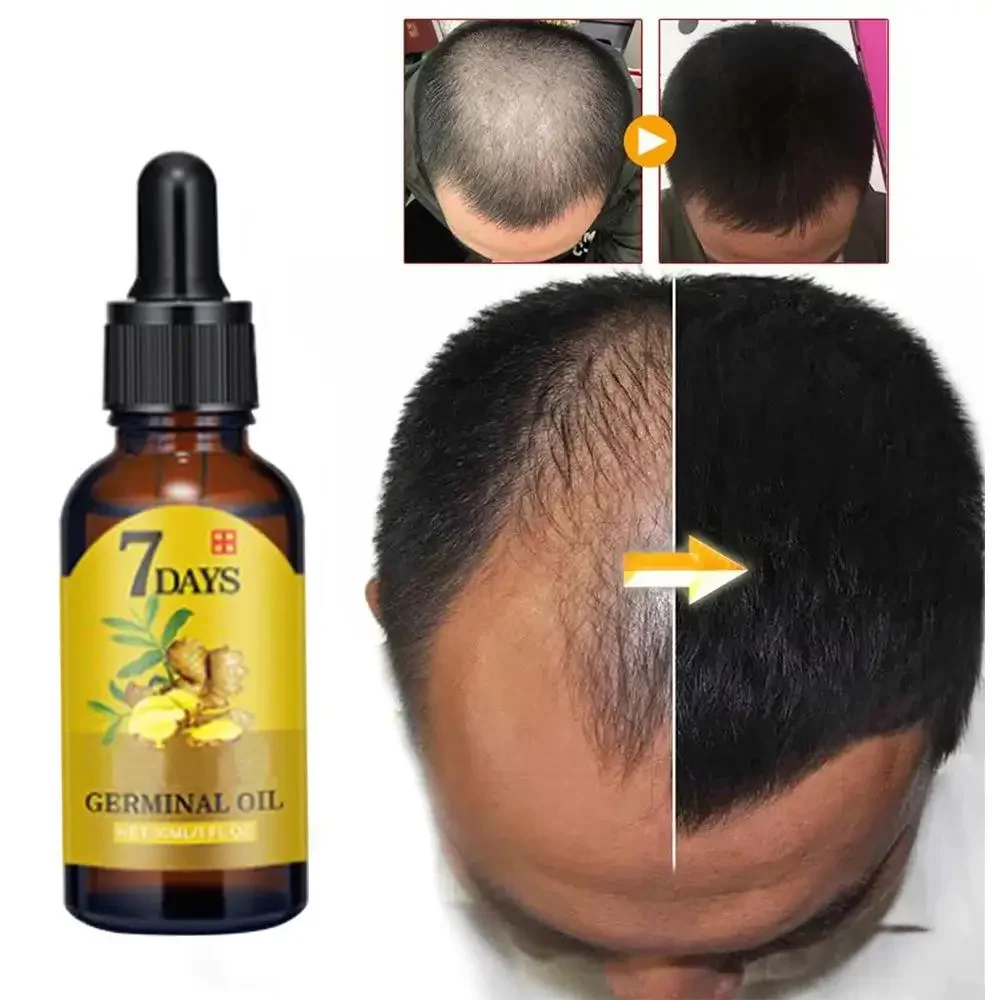 Hair Growth Ginger Fast Growin – Hair Care Fragrance Essential Oil Bewertung und Preis