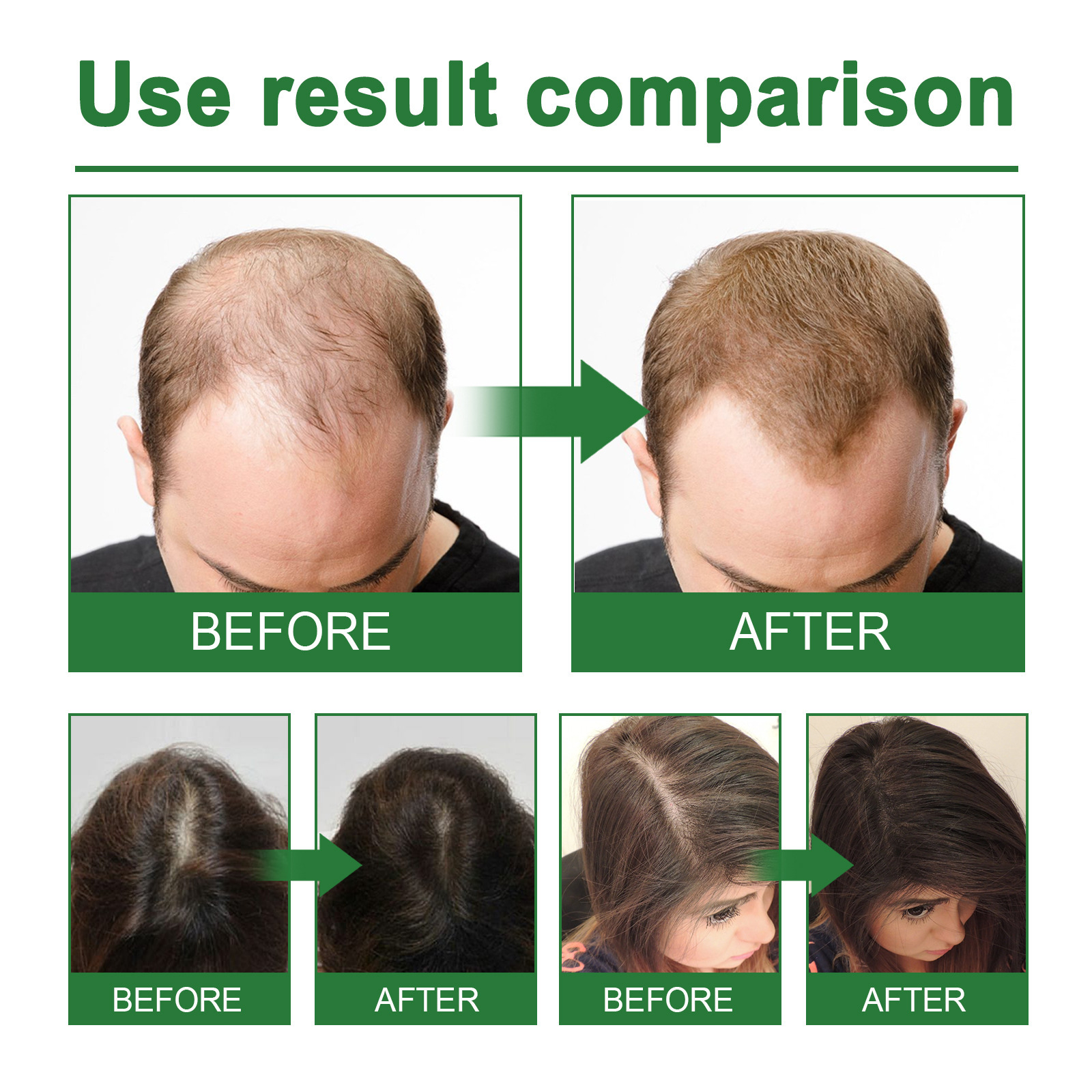 Rosemary Spray for Hair Nouris – Hair Care Naturally Bewertung und Preis